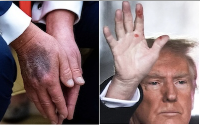 ¿De qué más estarán manchadas las manos del presidente Donald Trump?